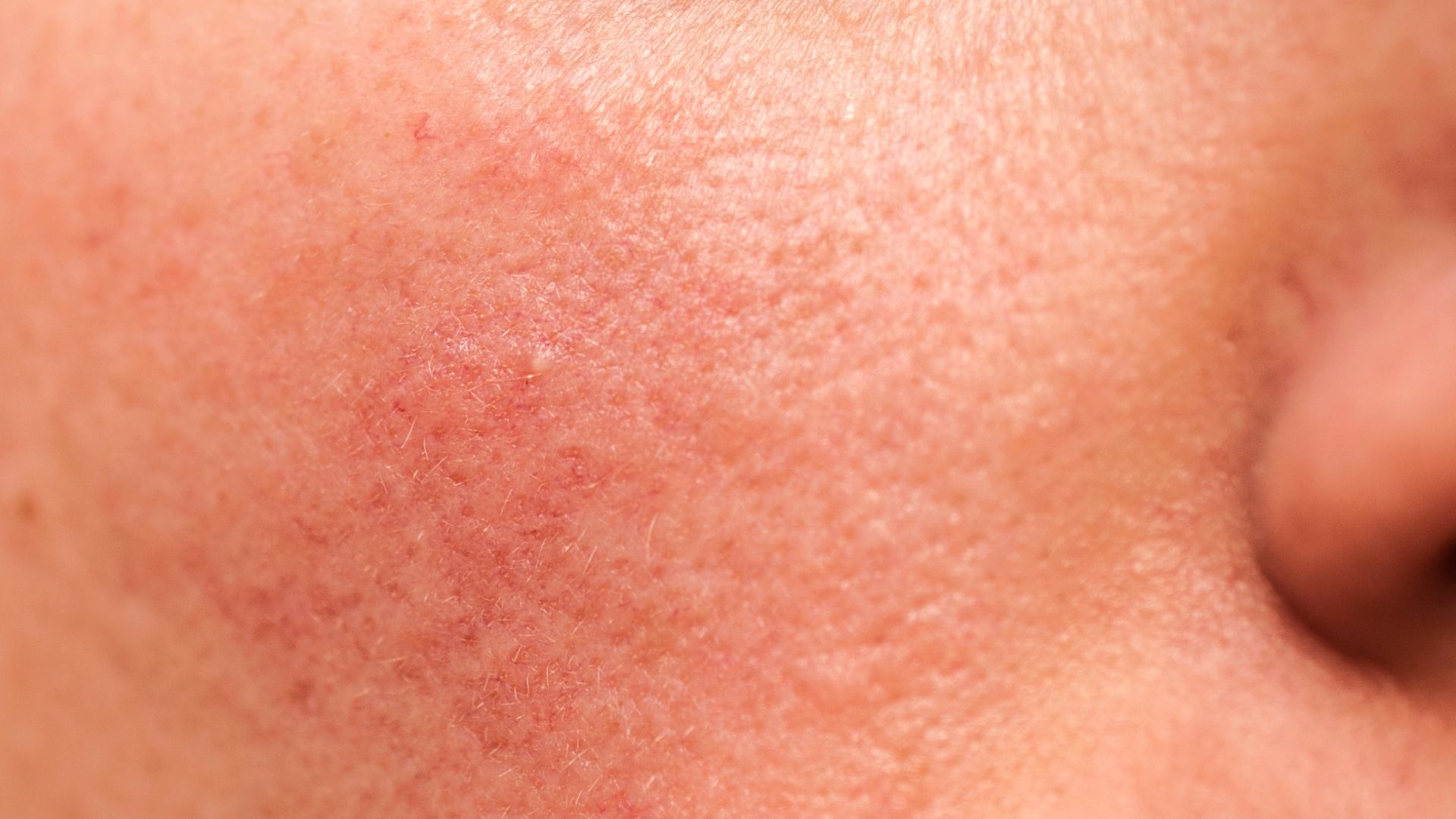 Rekomendasi Sunscreen buat Bapak Sesuai Permasalahan Kulit yang Dipunya