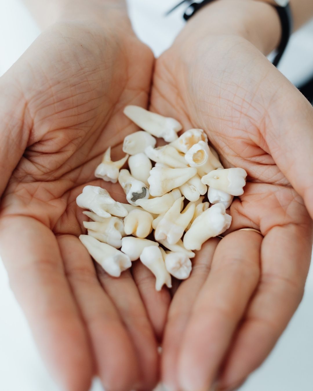 Scaling Gigi dan Obrolan Panjang yang Bikin Bingung Jawabnya Begimana